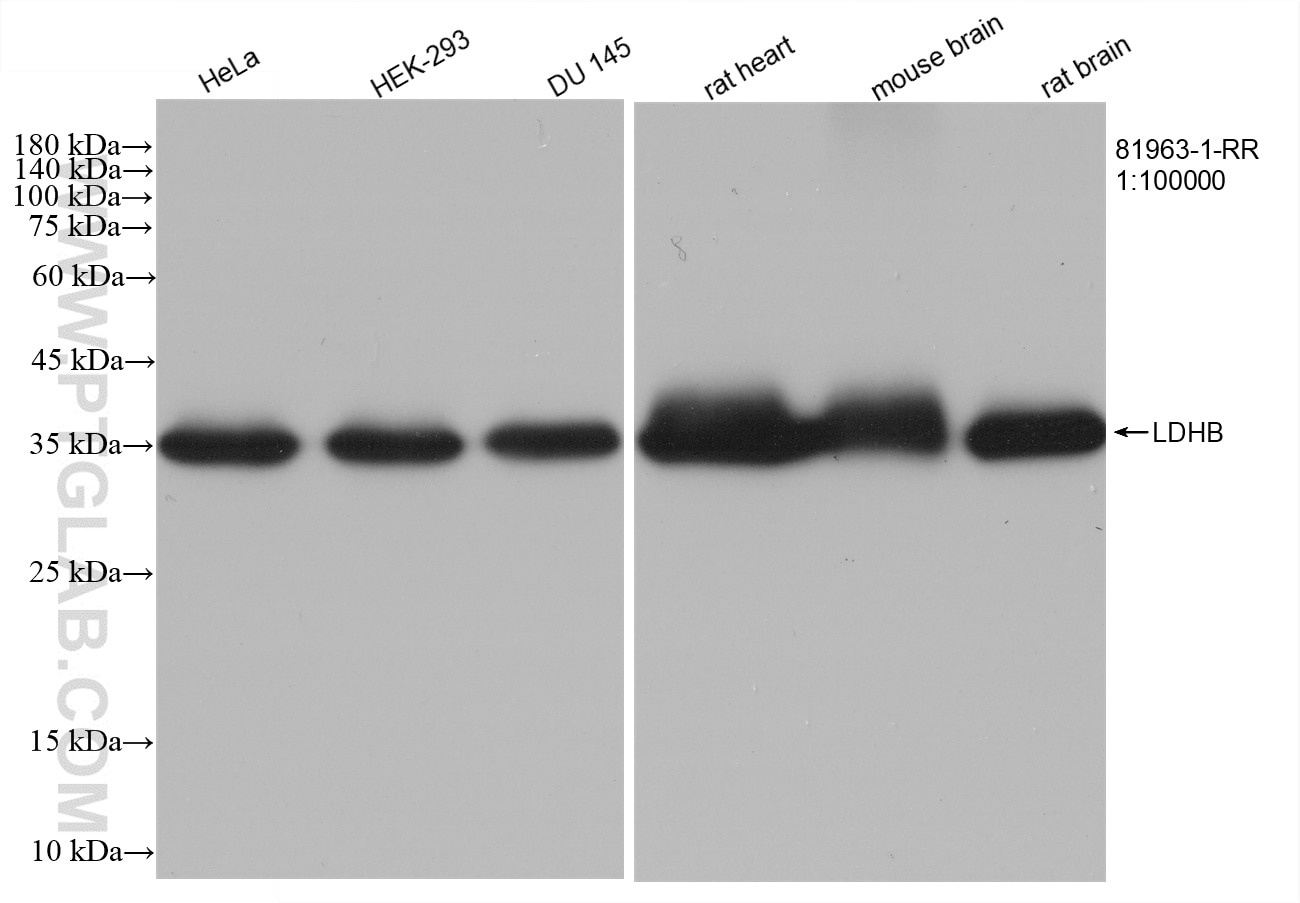 Western Blot (WB) analysis of various lysates using LDHB Recombinant antibody (81963-1-RR)