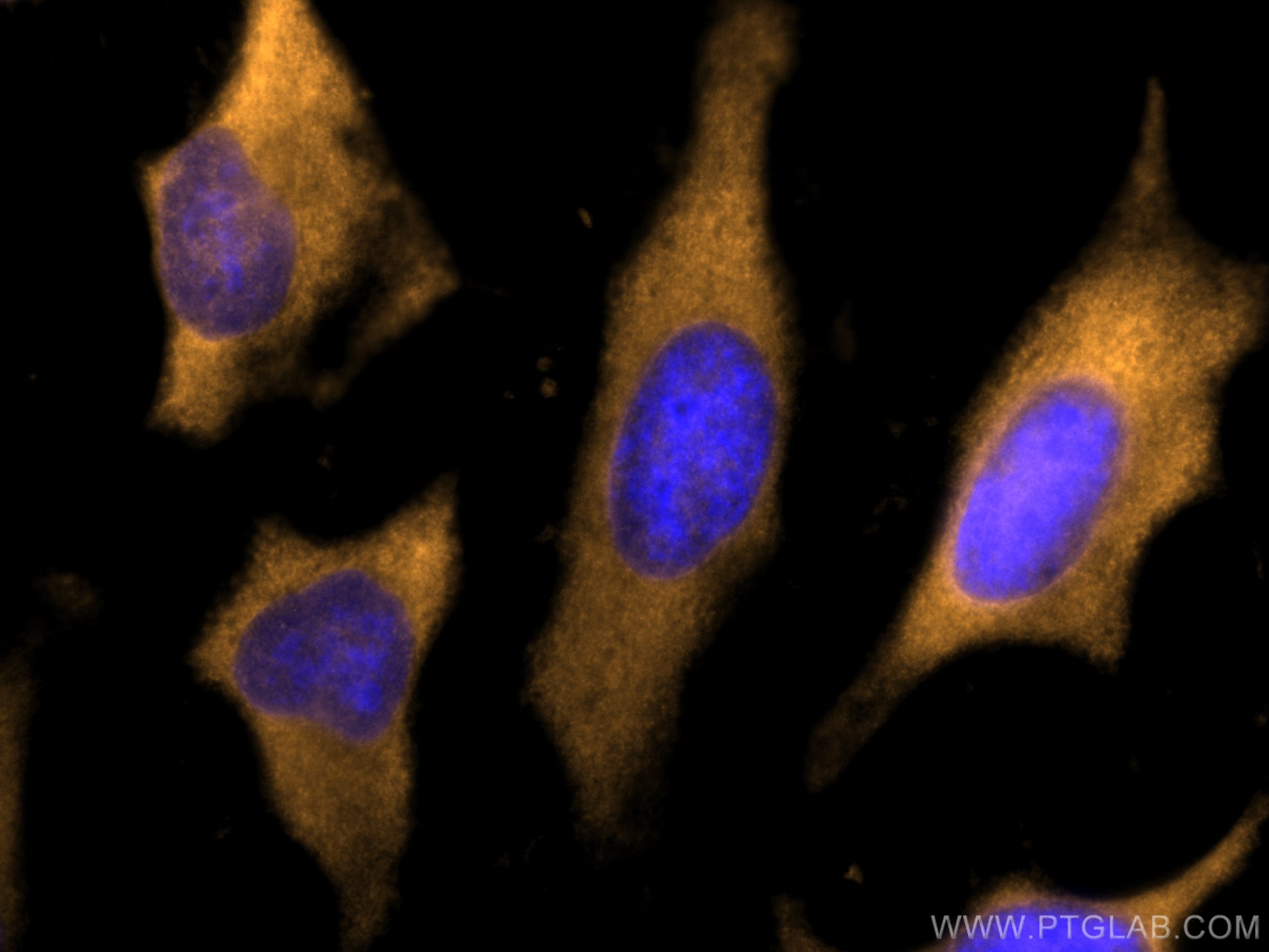 Immunofluorescence (IF) / fluorescent staining of HeLa cells using CoraLite®555-conjugated LDHB Polyclonal antibody (CL555-14824)