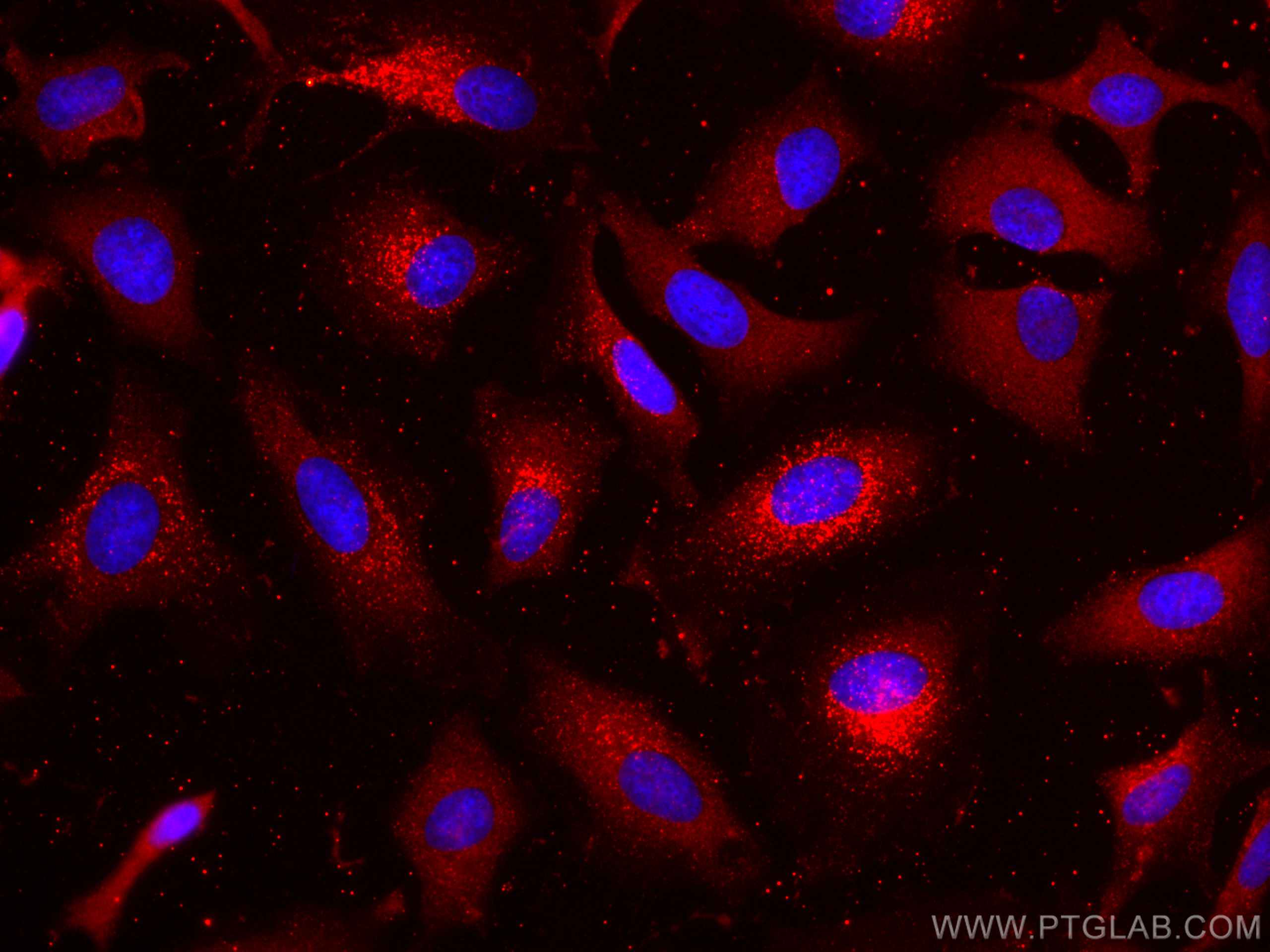 Immunofluorescence (IF) / fluorescent staining of HeLa cells using CoraLite®594-conjugated LDHB Monoclonal antibody (CL594-66425)