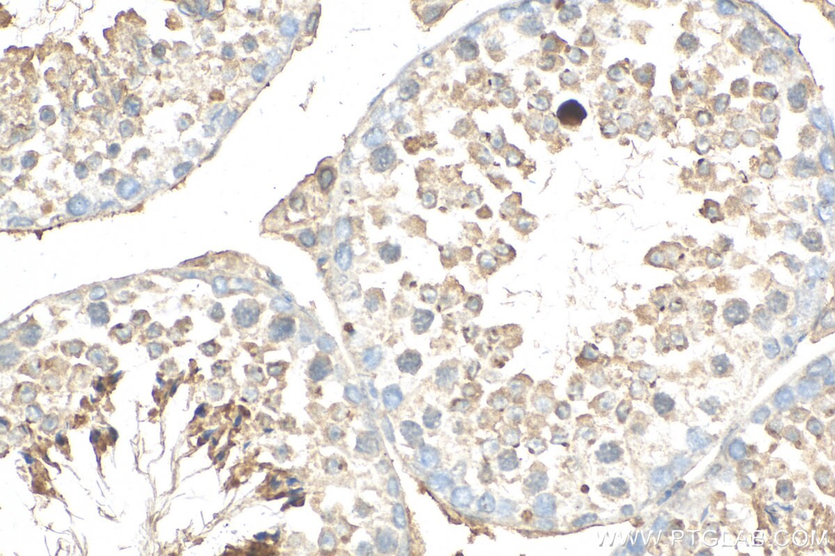 IHC staining of mouse testis using 14546-1-AP