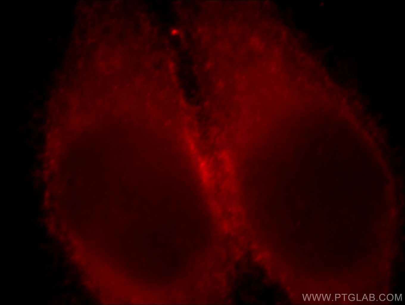 Immunofluorescence (IF) / fluorescent staining of HeLa cells using LDHC-Specific Polyclonal antibody (19989-1-AP)
