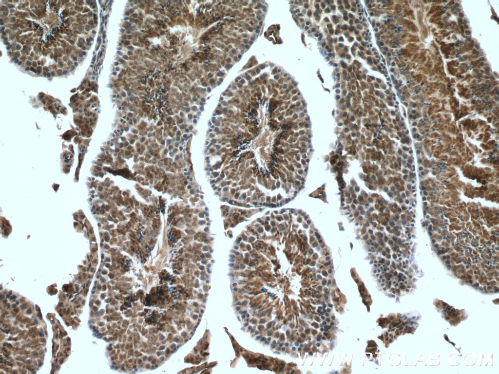 IHC staining of mouse testis using 19989-1-AP