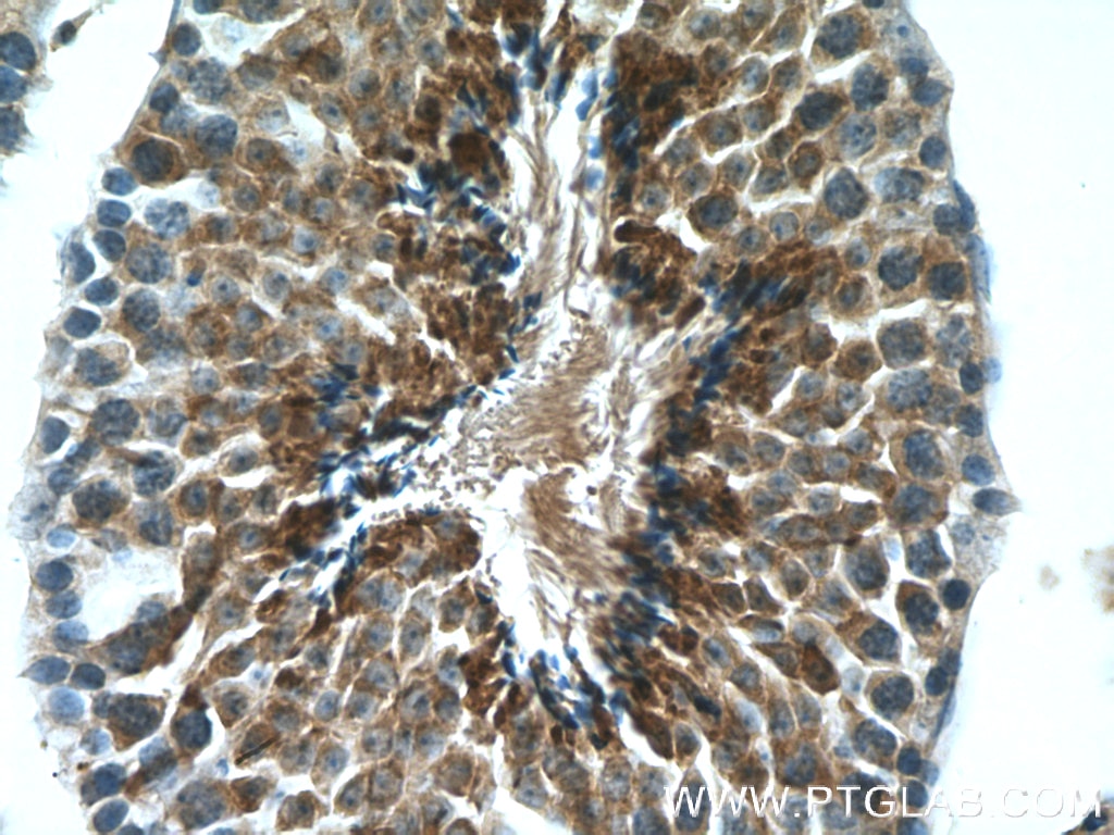 IHC staining of mouse testis using 19989-1-AP