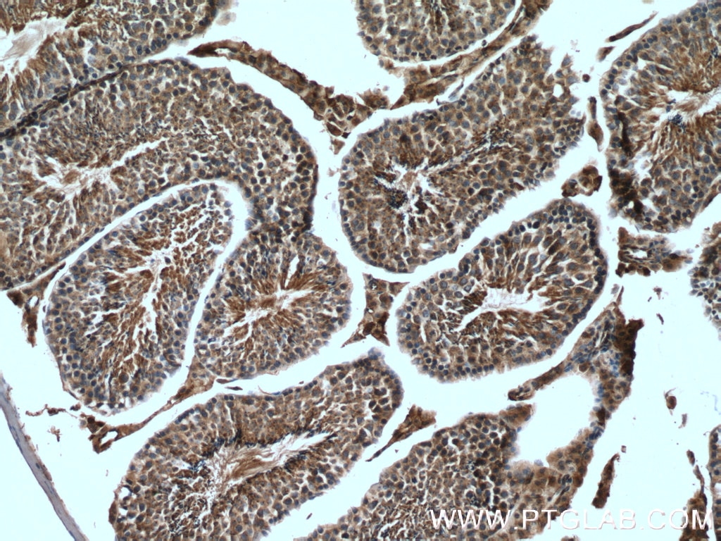 Immunohistochemistry (IHC) staining of mouse testis tissue using LDHC-Specific Polyclonal antibody (19989-1-AP)