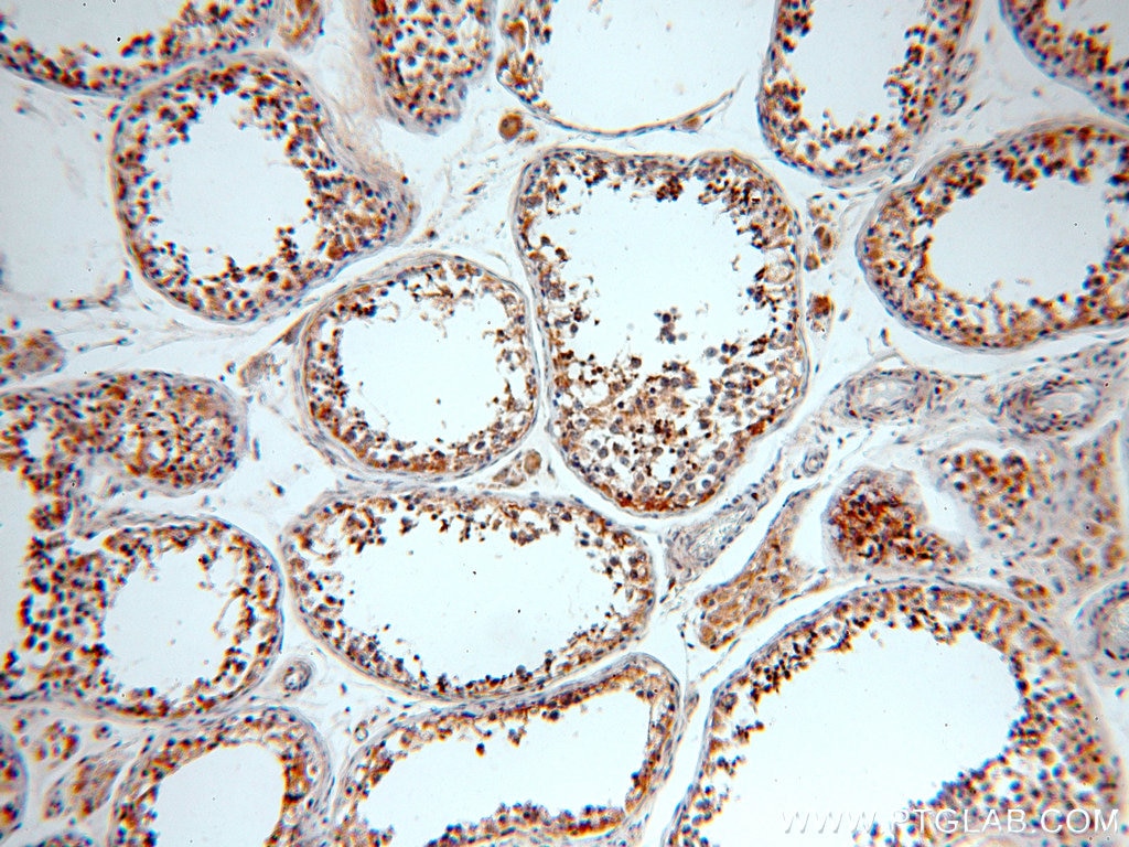 Immunohistochemistry (IHC) staining of human testis tissue using LDHC-Specific Polyclonal antibody (19989-1-AP)