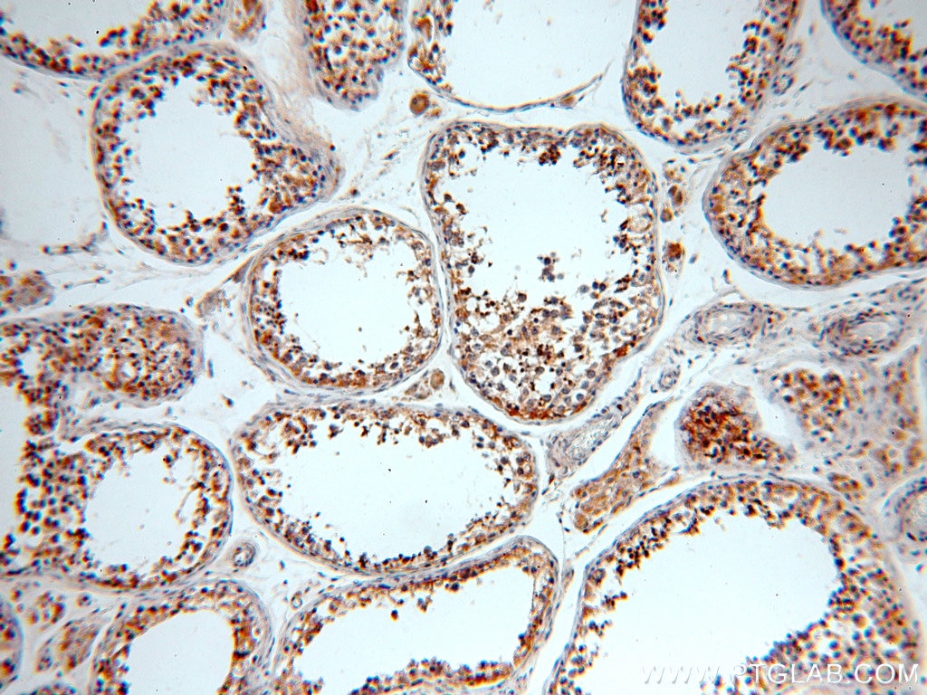 IHC staining of human testis using 19989-1-AP