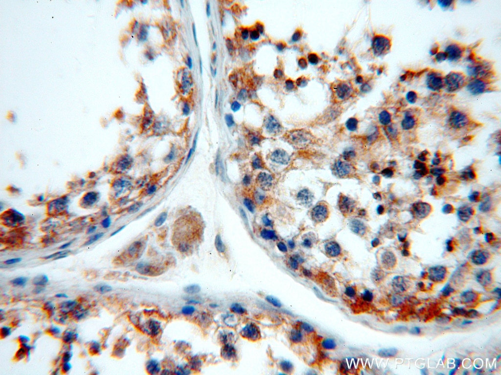 IHC staining of human testis using 19989-1-AP