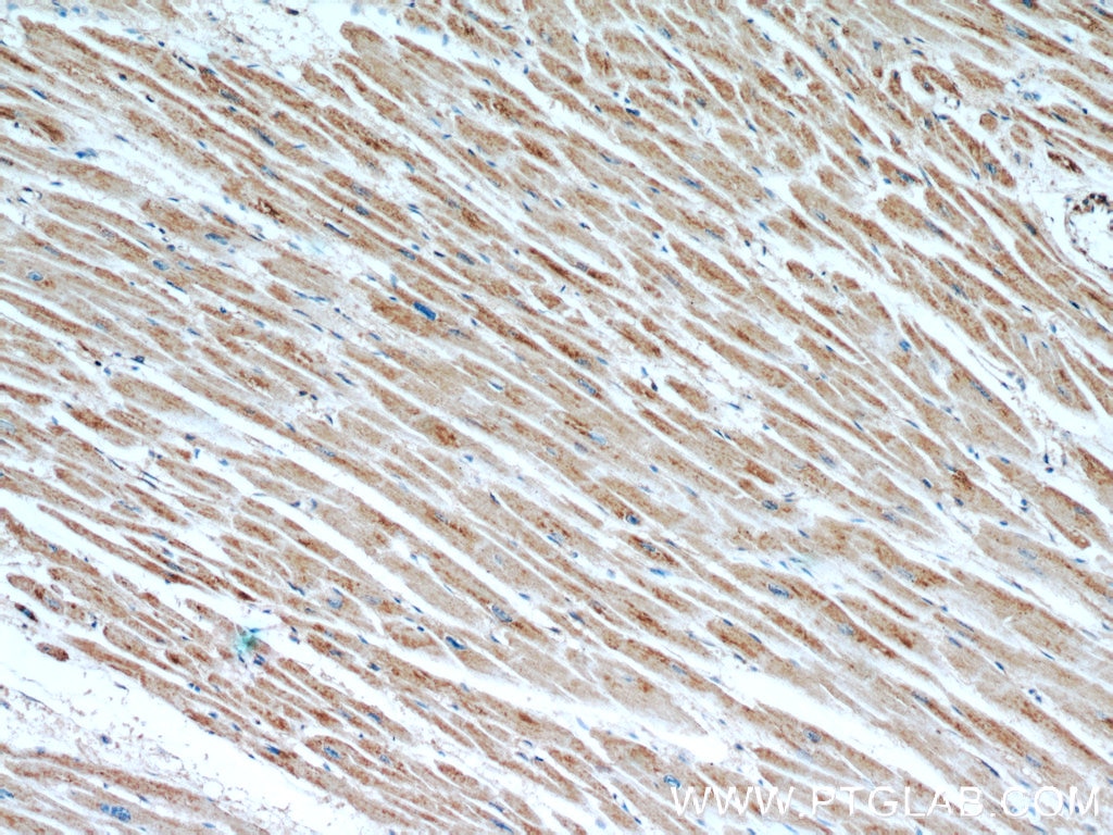 Immunohistochemistry (IHC) staining of human heart tissue using LDHC-Specific Polyclonal antibody (19989-1-AP)