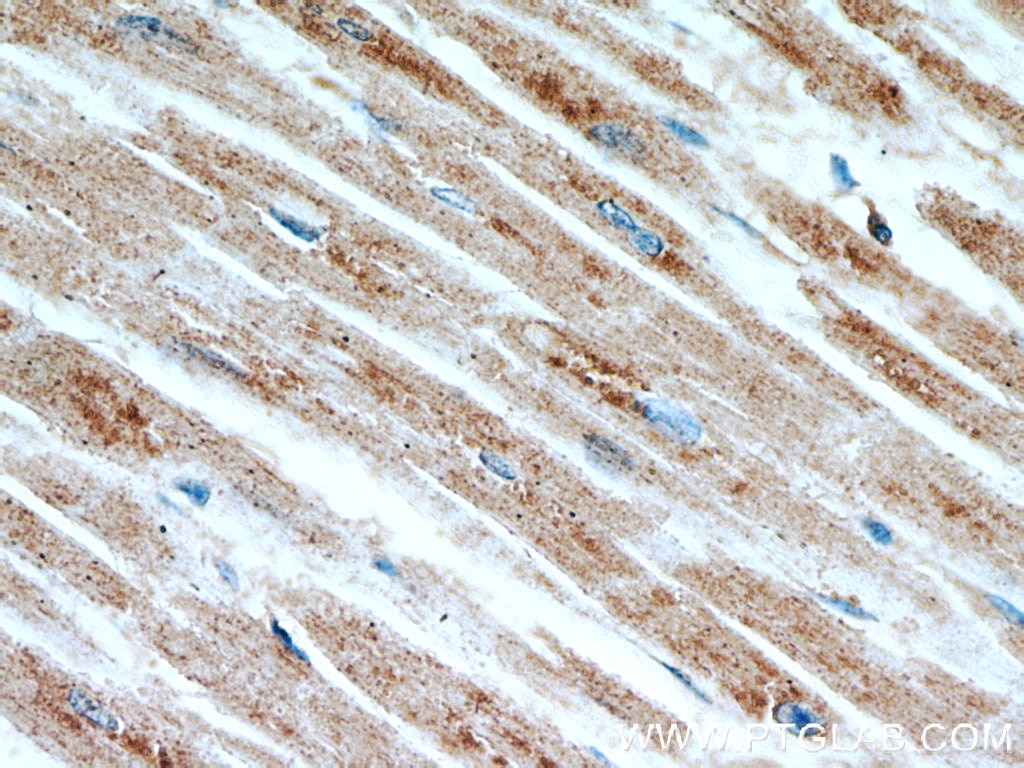 Immunohistochemistry (IHC) staining of human heart tissue using LDHC-Specific Polyclonal antibody (19989-1-AP)