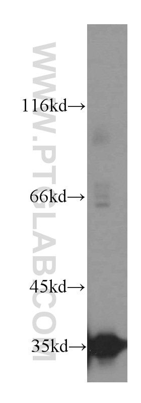 Western Blot (WB) analysis of human testis tissue using LDHC-Specific Polyclonal antibody (19989-1-AP)