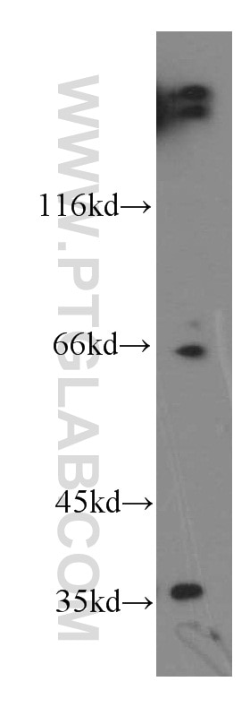 Western Blot (WB) analysis of A549 cells using LDHC-Specific Polyclonal antibody (19989-1-AP)