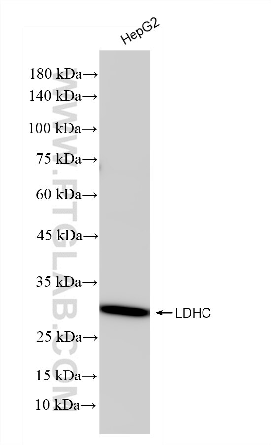 LDHC