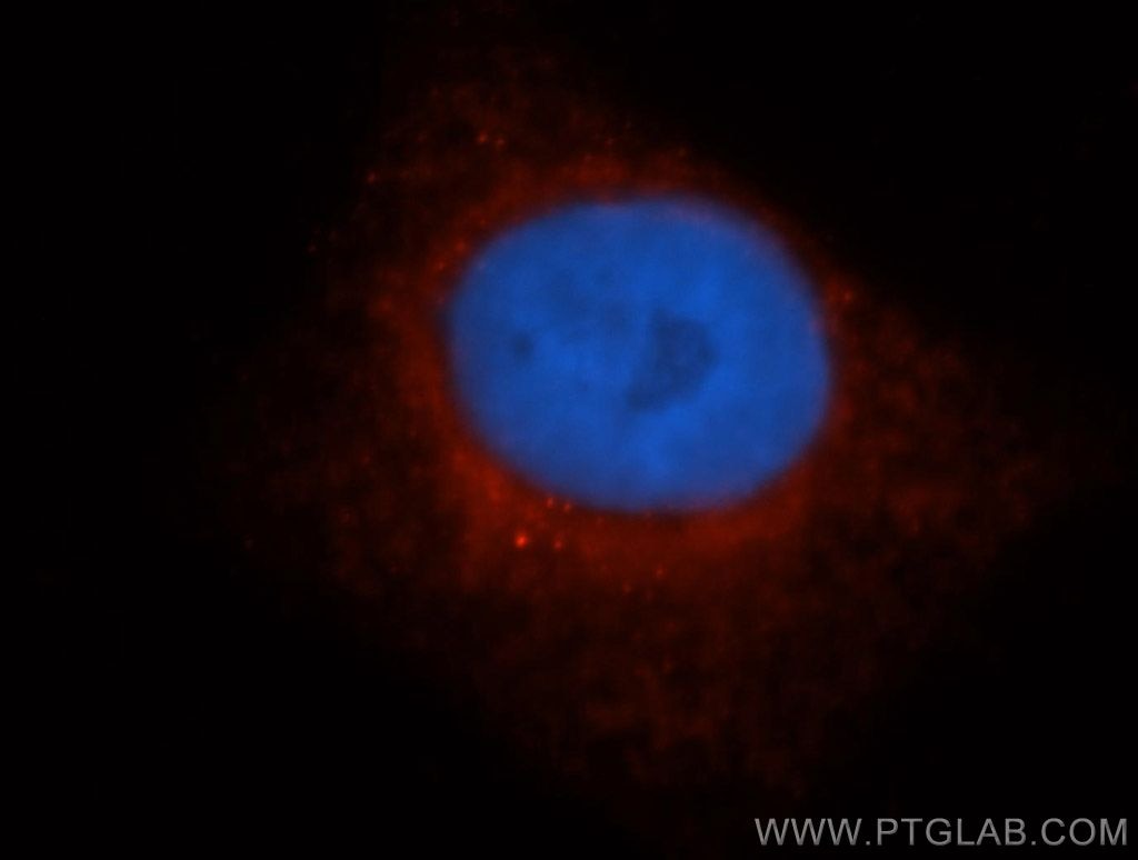 Immunofluorescence (IF) / fluorescent staining of HepG2 cells using LDHD Polyclonal antibody (14398-1-AP)
