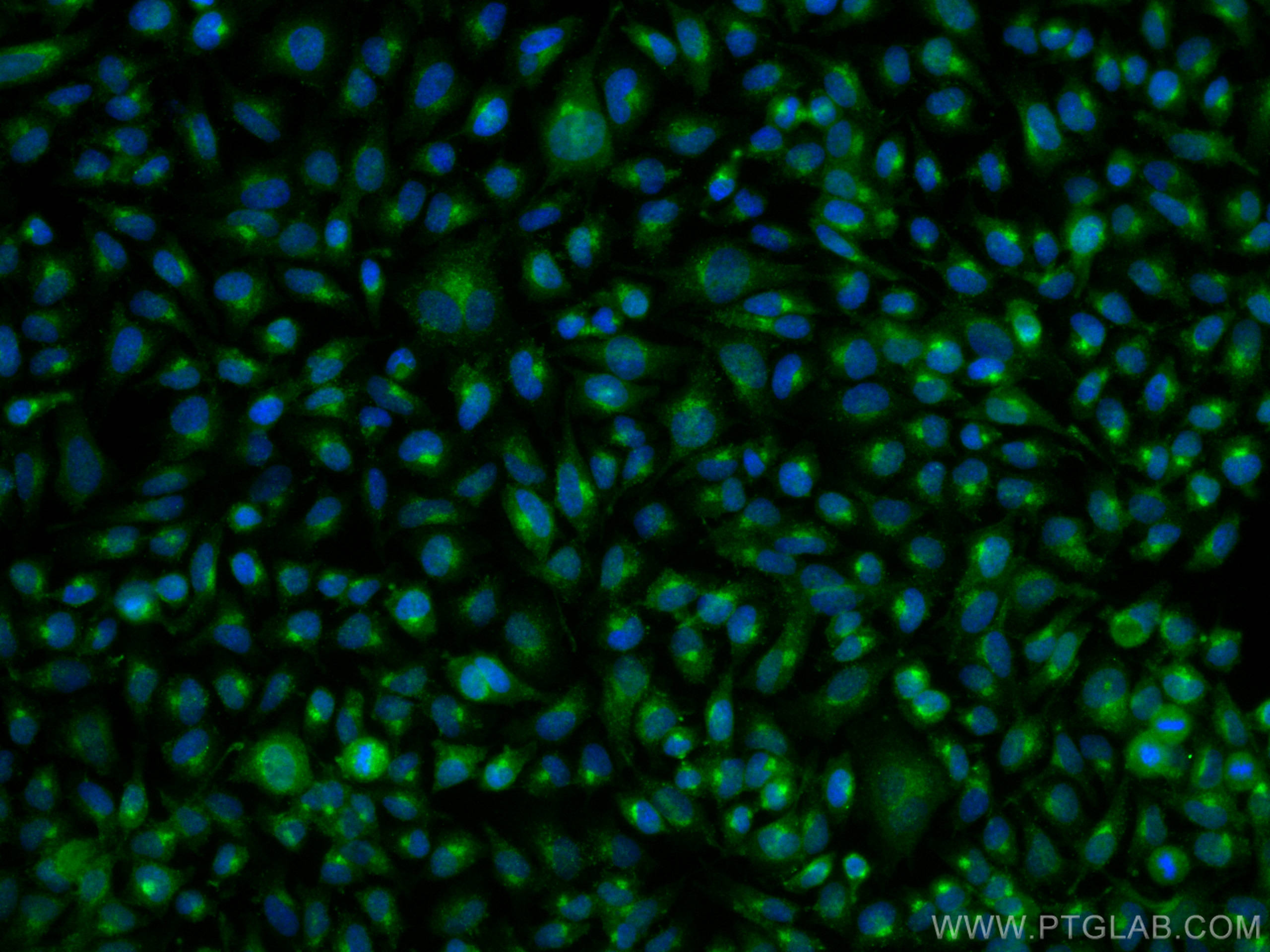 Immunofluorescence (IF) / fluorescent staining of HeLa cells using LDLR Polyclonal antibody (10785-1-AP)