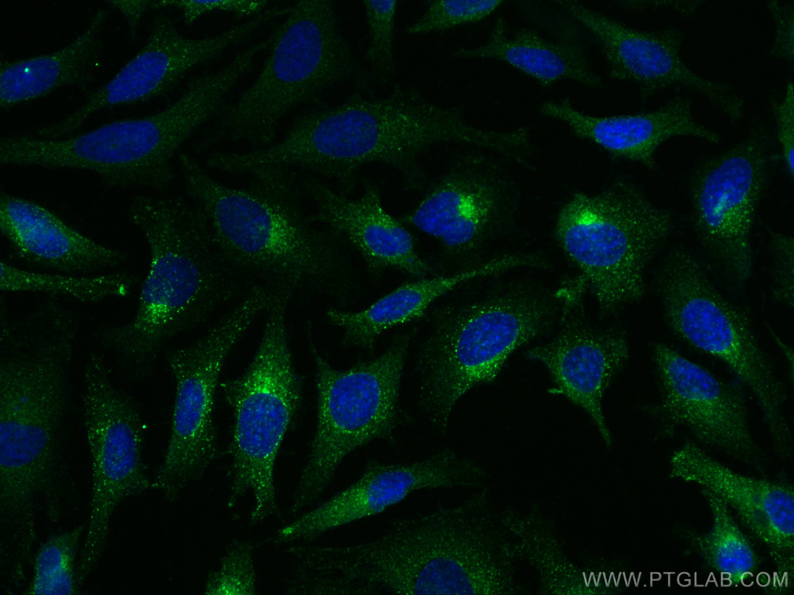 Immunofluorescence (IF) / fluorescent staining of HeLa cells using LDLR Polyclonal antibody (10785-1-AP)