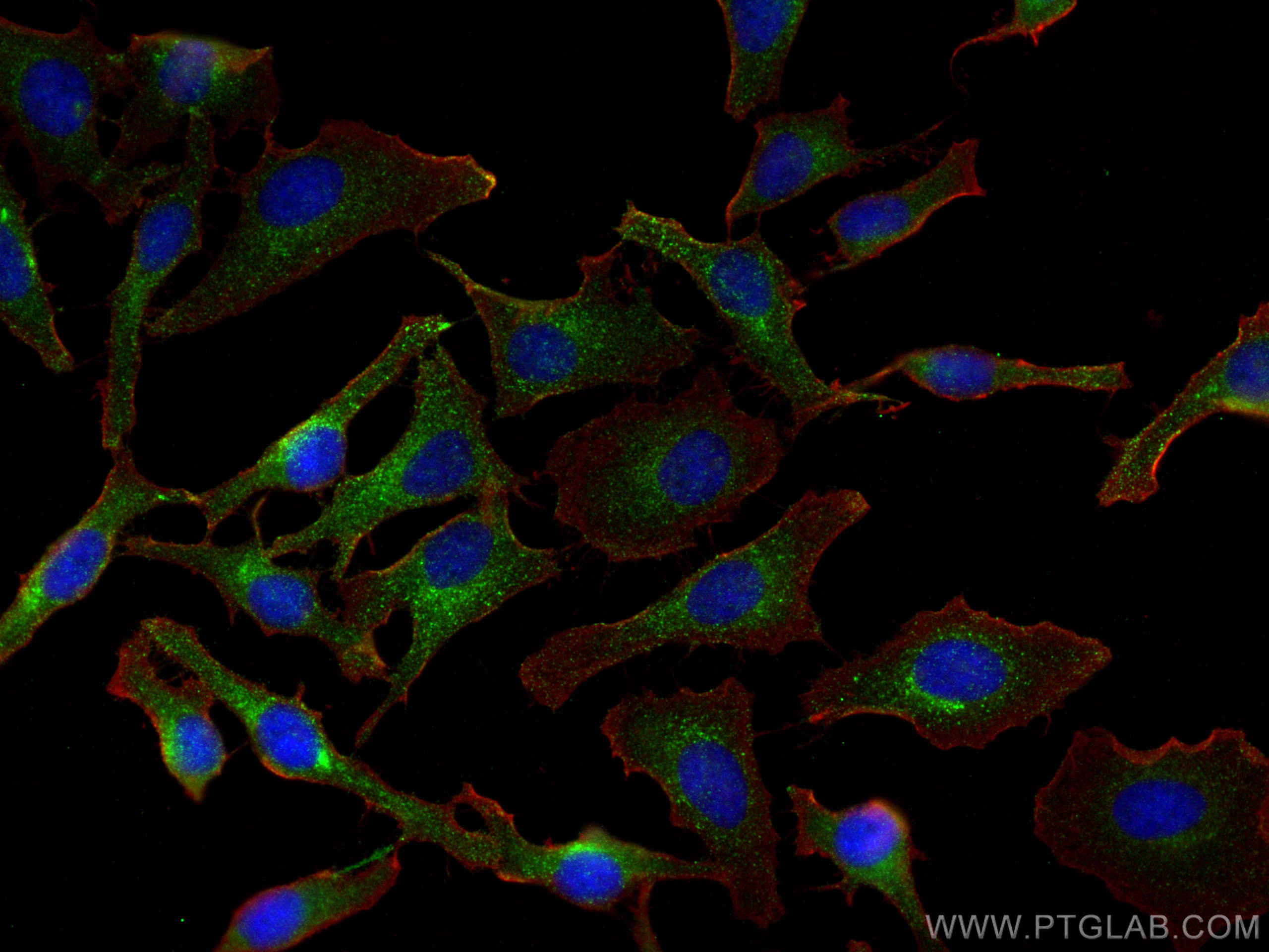Immunofluorescence (IF) / fluorescent staining of HeLa cells using LDLR Polyclonal antibody (10785-1-AP)