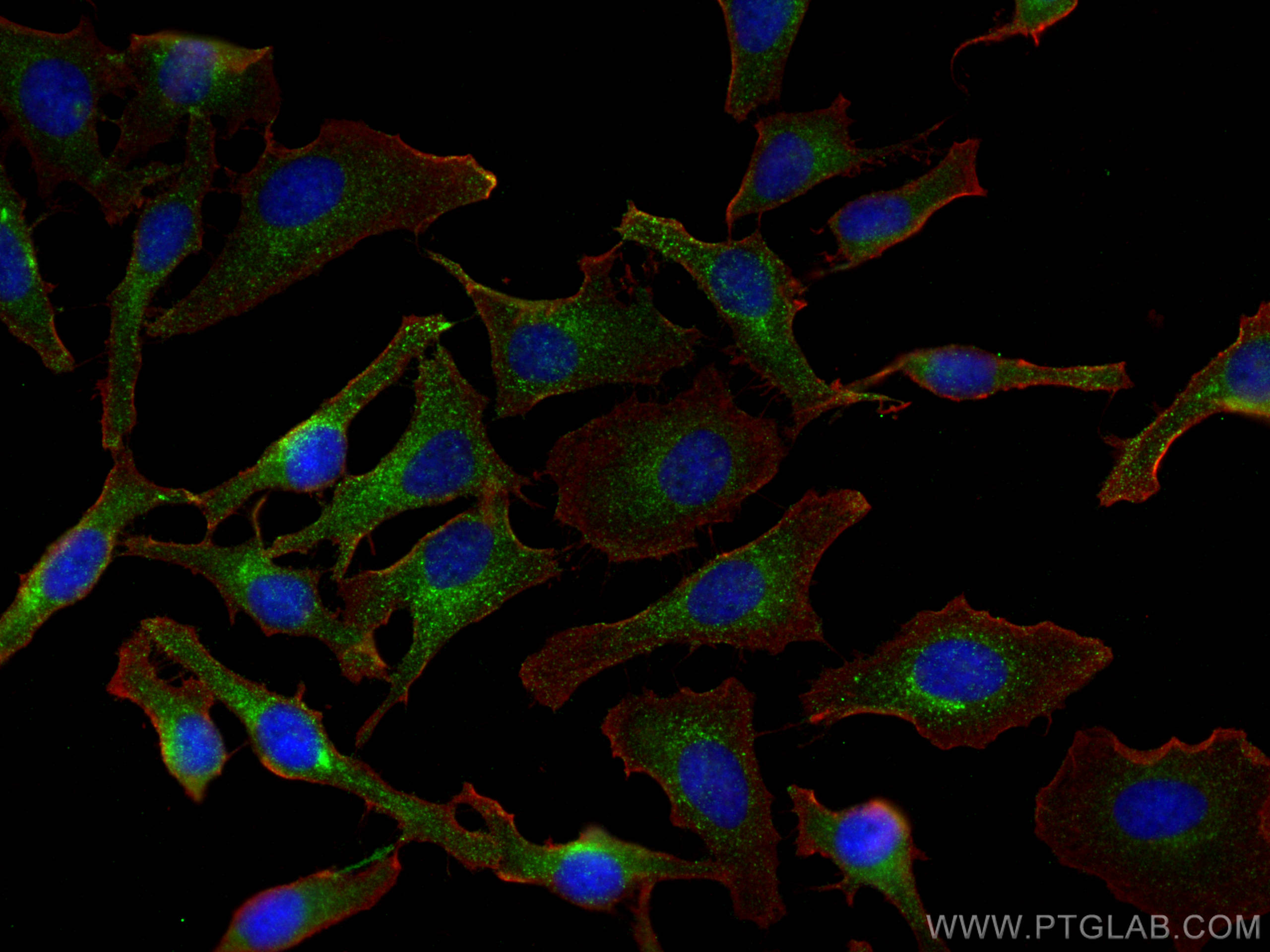 IF Staining of HeLa using 10785-1-AP