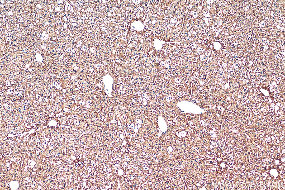 Immunohistochemistry (IHC) staining of mouse liver tissue using LDLR Polyclonal antibody (10785-1-AP)
