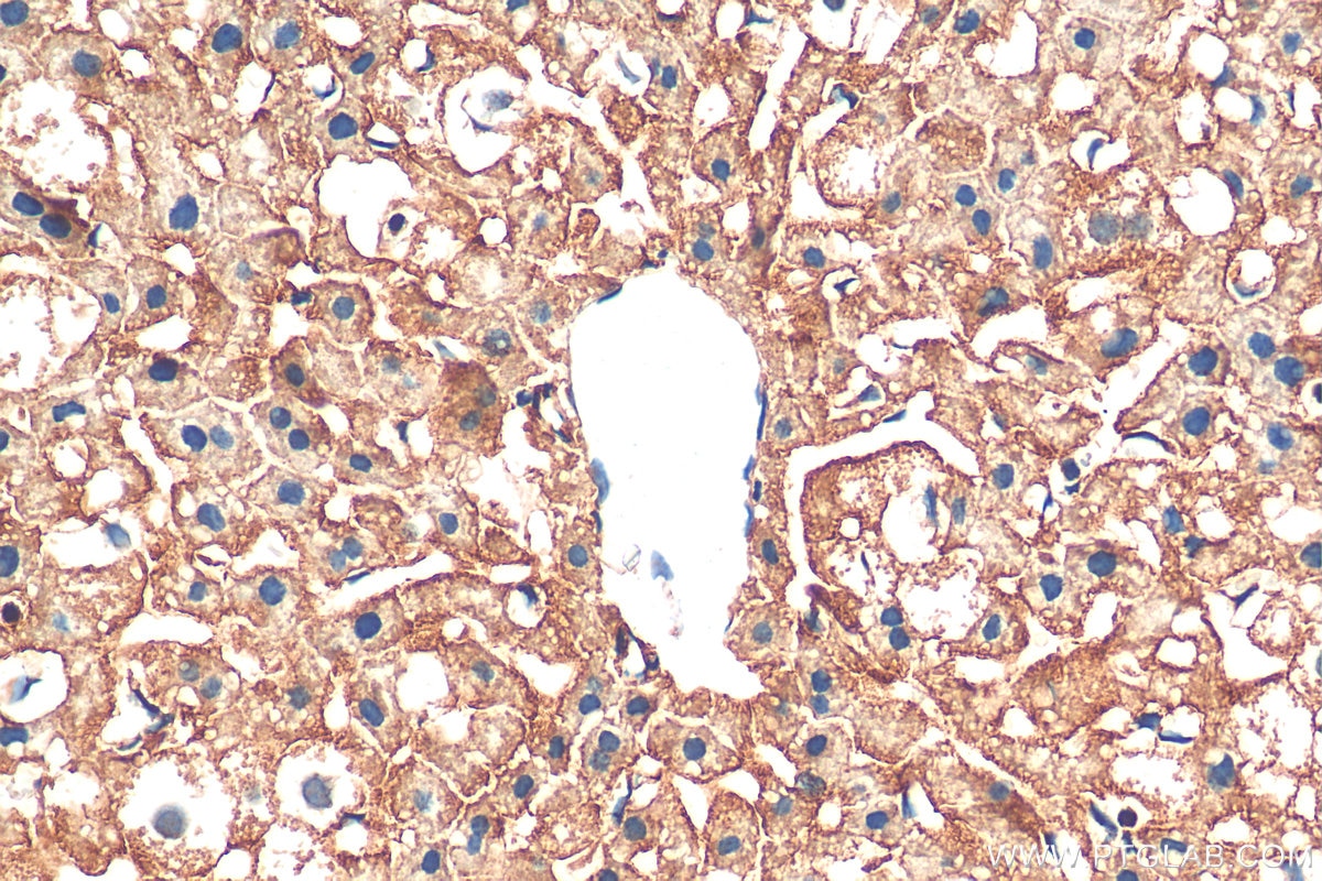 Immunohistochemistry (IHC) staining of mouse liver tissue using LDLR Polyclonal antibody (10785-1-AP)