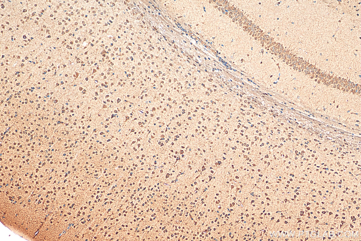 Immunohistochemistry (IHC) staining of mouse brain tissue using LDLR Polyclonal antibody (10785-1-AP)