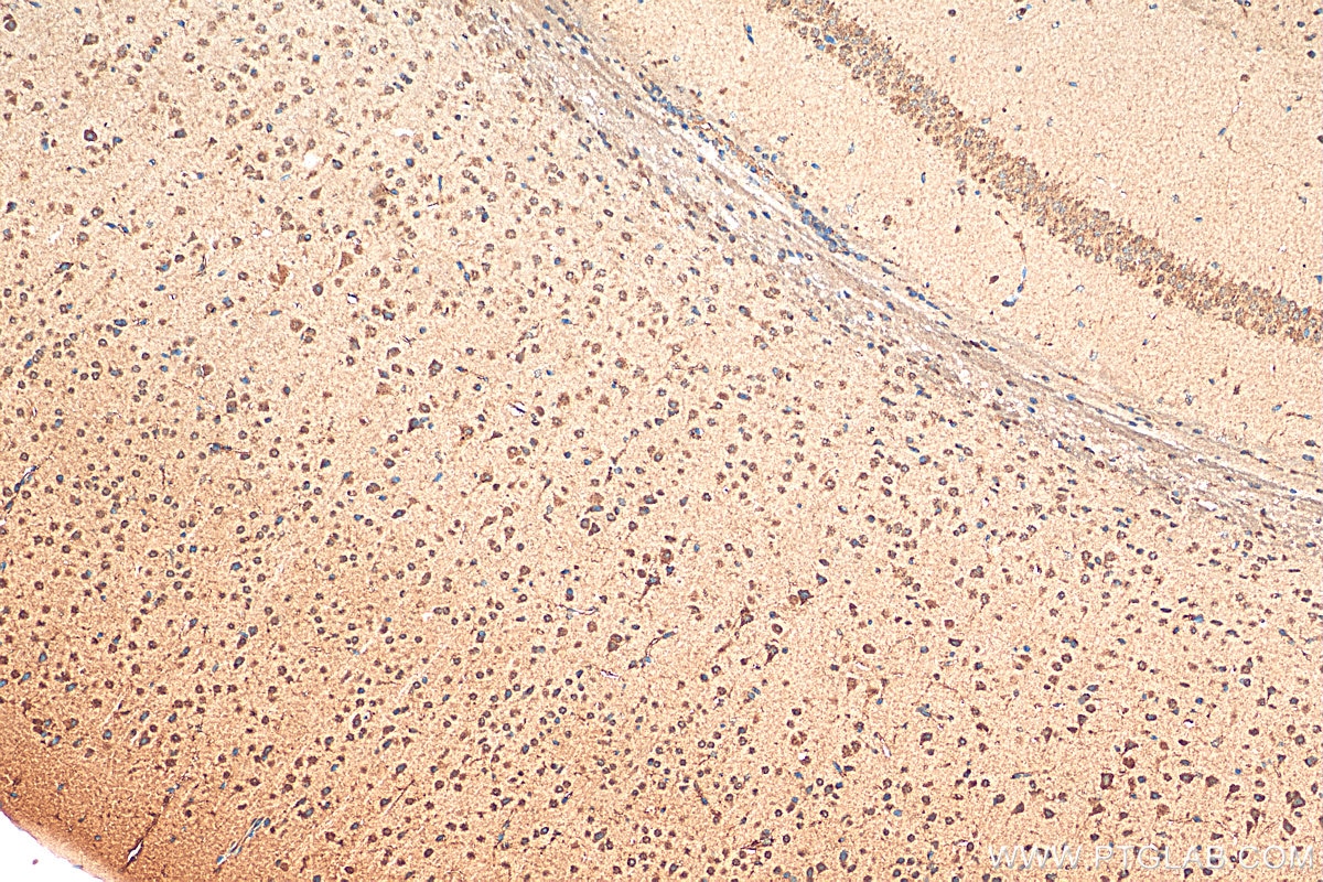 IHC staining of mouse brain using 10785-1-AP