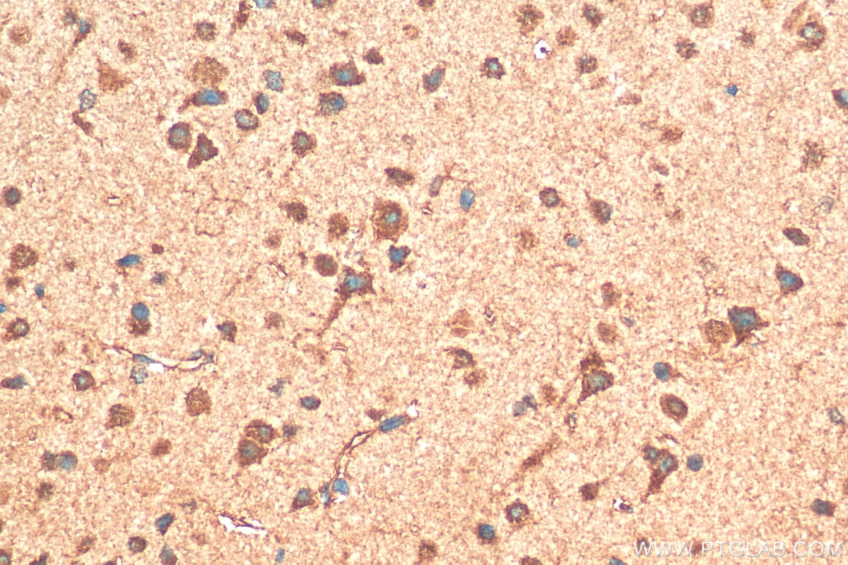 IHC staining of mouse brain using 10785-1-AP