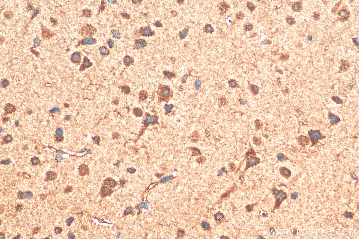 Immunohistochemistry (IHC) staining of mouse brain tissue using LDLR Polyclonal antibody (10785-1-AP)