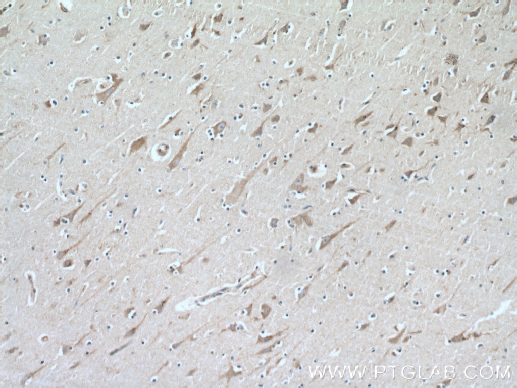 Immunohistochemistry (IHC) staining of human brain tissue using LDLR Polyclonal antibody (10785-1-AP)