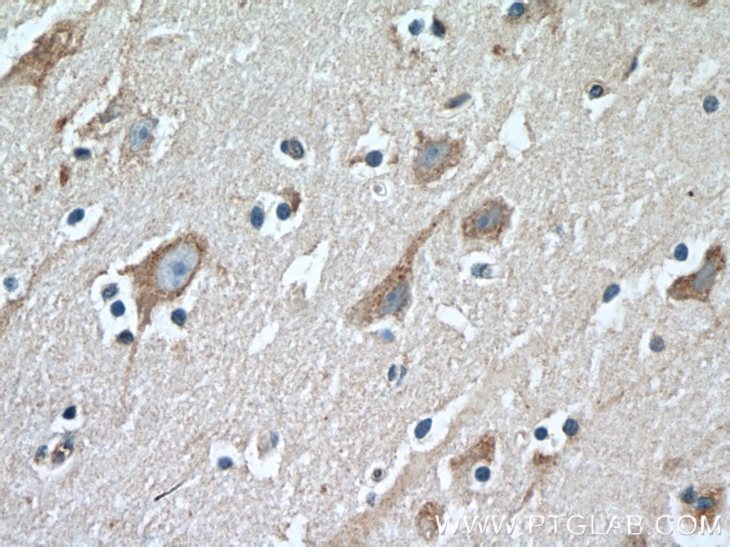 Immunohistochemistry (IHC) staining of human brain tissue using LDLR Polyclonal antibody (10785-1-AP)