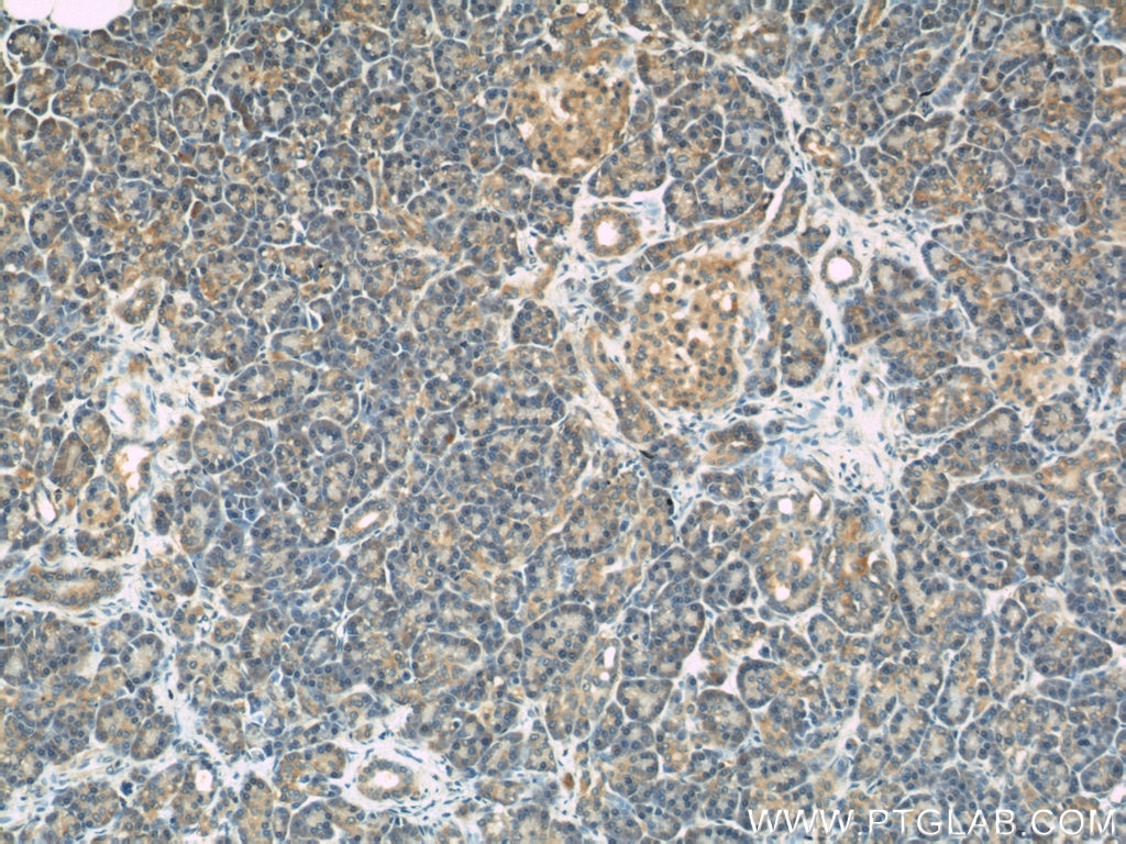 Immunohistochemistry (IHC) staining of human pancreas tissue using LDLR Polyclonal antibody (10785-1-AP)