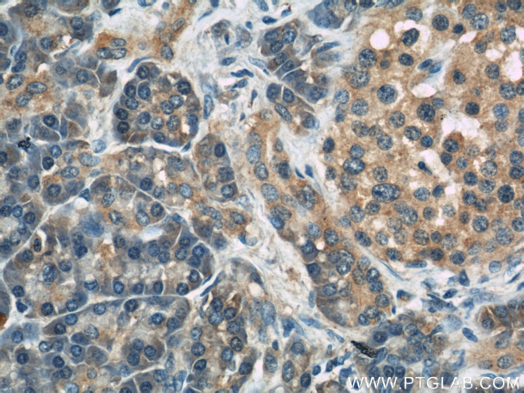 Immunohistochemistry (IHC) staining of human pancreas tissue using LDLR Polyclonal antibody (10785-1-AP)