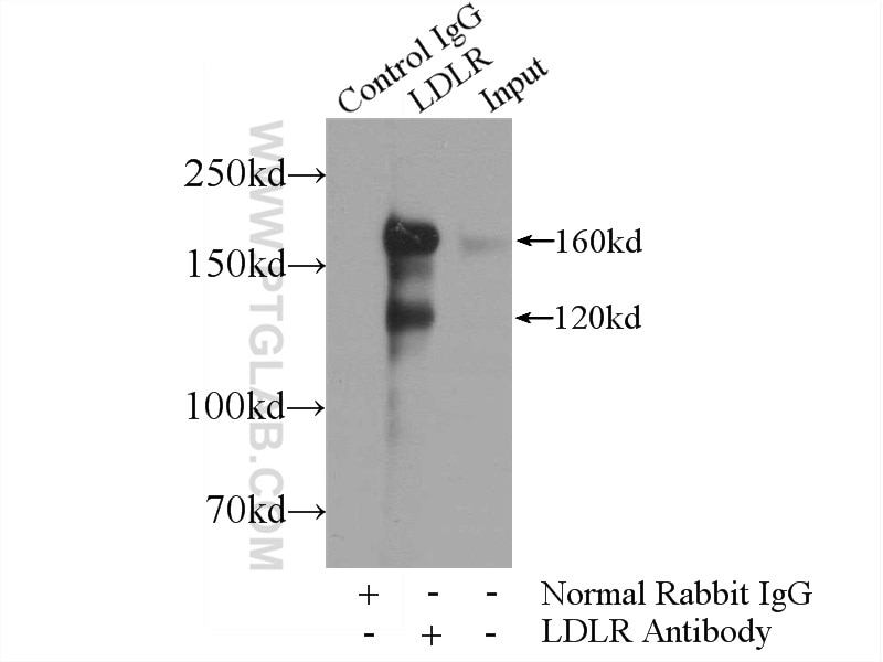Immunoprecipitation (IP) experiment of HeLa cells using LDLR Polyclonal antibody (10785-1-AP)
