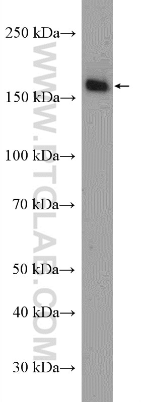 Western Blot (WB) analysis of HeLa cells using LDLR Polyclonal antibody (10785-1-AP)