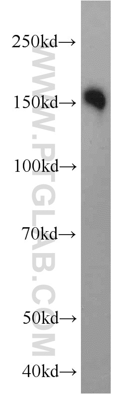 Western Blot (WB) analysis of mouse brain tissue using LDLR Polyclonal antibody (10785-1-AP)