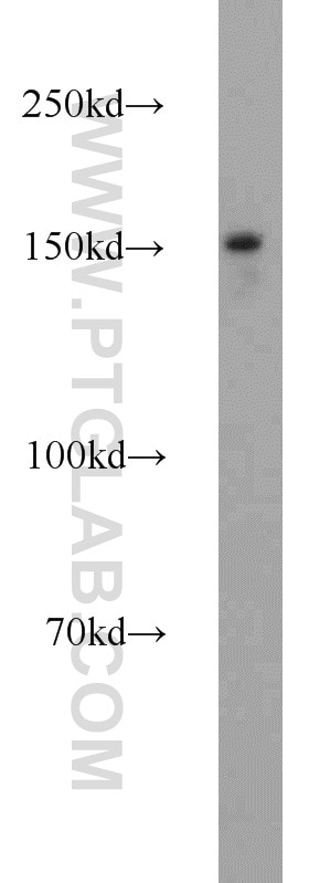 Western Blot (WB) analysis of HL-60 cells using LDLR Polyclonal antibody (10785-1-AP)