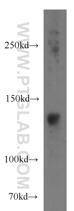 Western Blot (WB) analysis of human brain tissue using LDLR Polyclonal antibody (10785-1-AP)