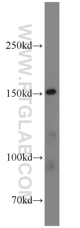 Western Blot (WB) analysis of Jurkat cells using LDLR Polyclonal antibody (10785-1-AP)