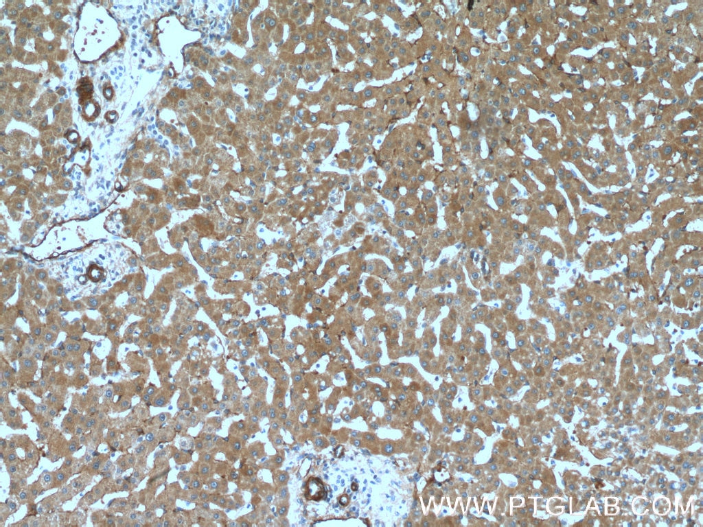 Immunohistochemistry (IHC) staining of human liver tissue using LDLR Monoclonal antibody (66414-1-Ig)