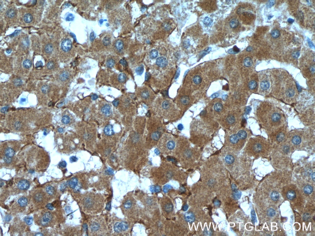 Immunohistochemistry (IHC) staining of human liver tissue using LDLR Monoclonal antibody (66414-1-Ig)