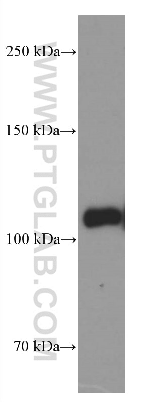 Western Blot (WB) analysis of HeLa cells using LDLR Monoclonal antibody (66414-1-Ig)