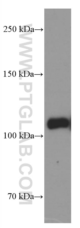 WB analysis of HeLa using 66414-1-Ig