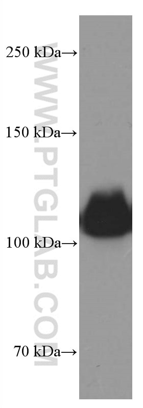 WB analysis of HEK-293 using 66414-1-Ig