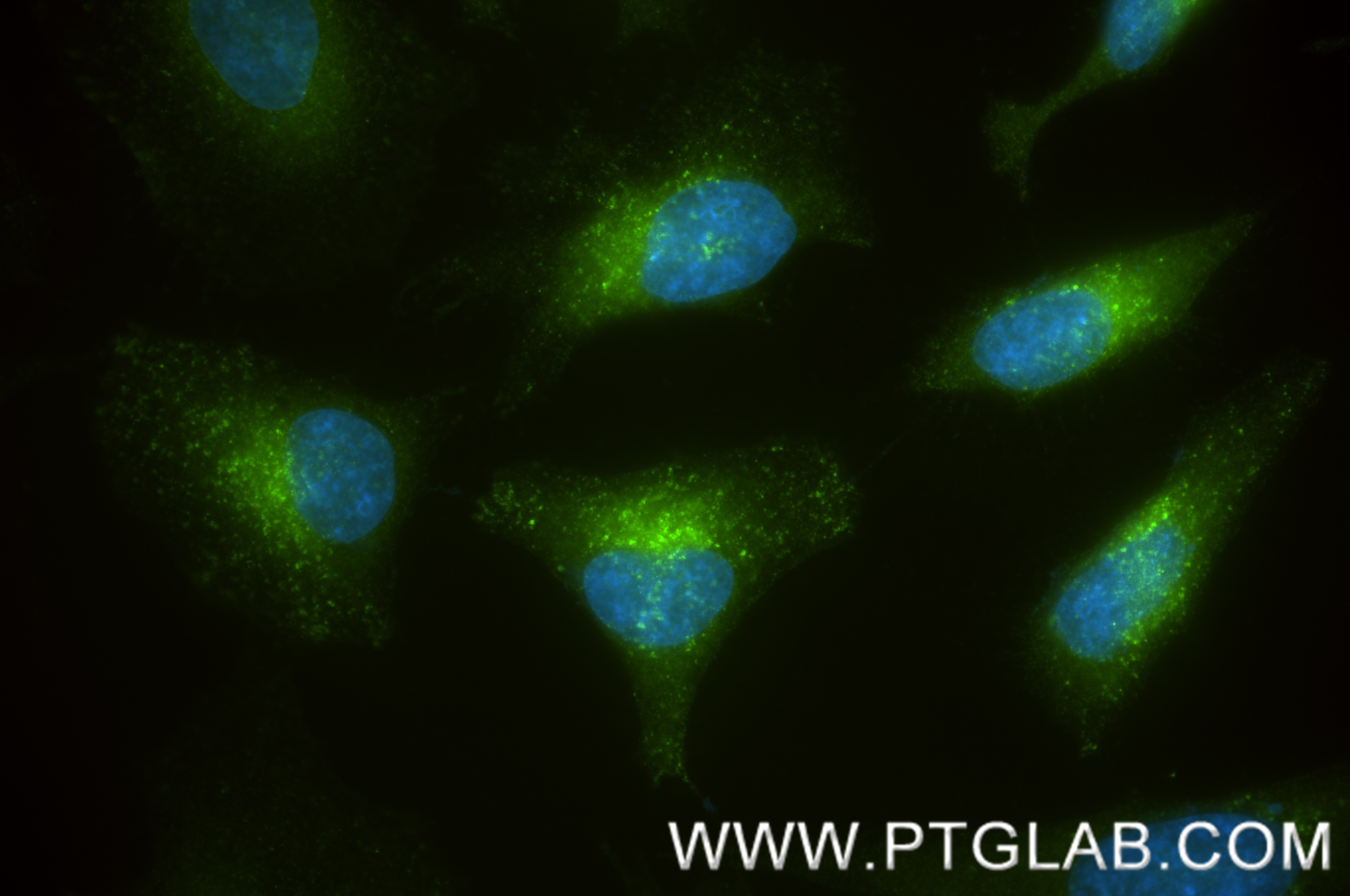 Immunofluorescence (IF) / fluorescent staining of HeLa cells using LDLR Recombinant antibody (82724-1-RR)