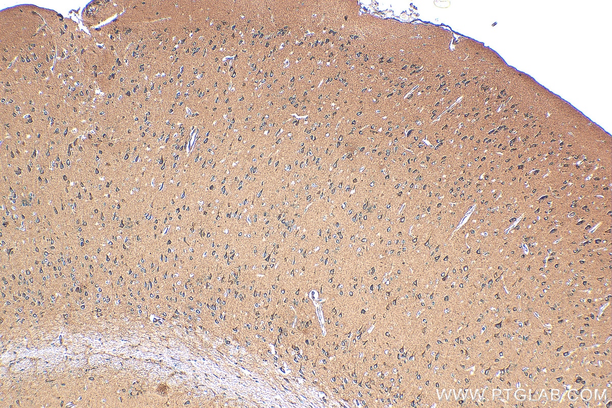 Immunohistochemistry (IHC) staining of mouse brain tissue using LDLR Recombinant antibody (82724-1-RR)