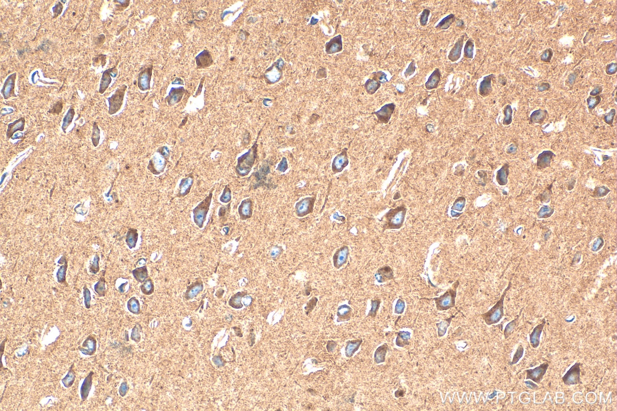 Immunohistochemistry (IHC) staining of mouse brain tissue using LDLR Recombinant antibody (82724-1-RR)