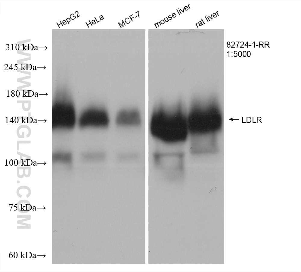 Western Blot (WB) analysis of various lysates using LDLR Recombinant antibody (82724-1-RR)