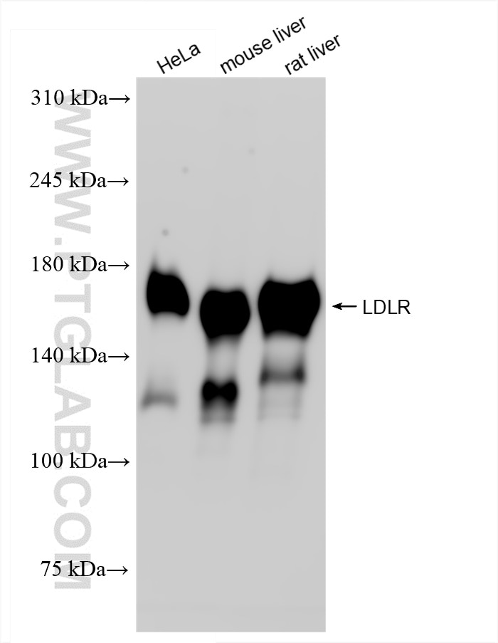 Western Blot (WB) analysis of various lysates using LDLR Recombinant antibody (82724-1-RR)