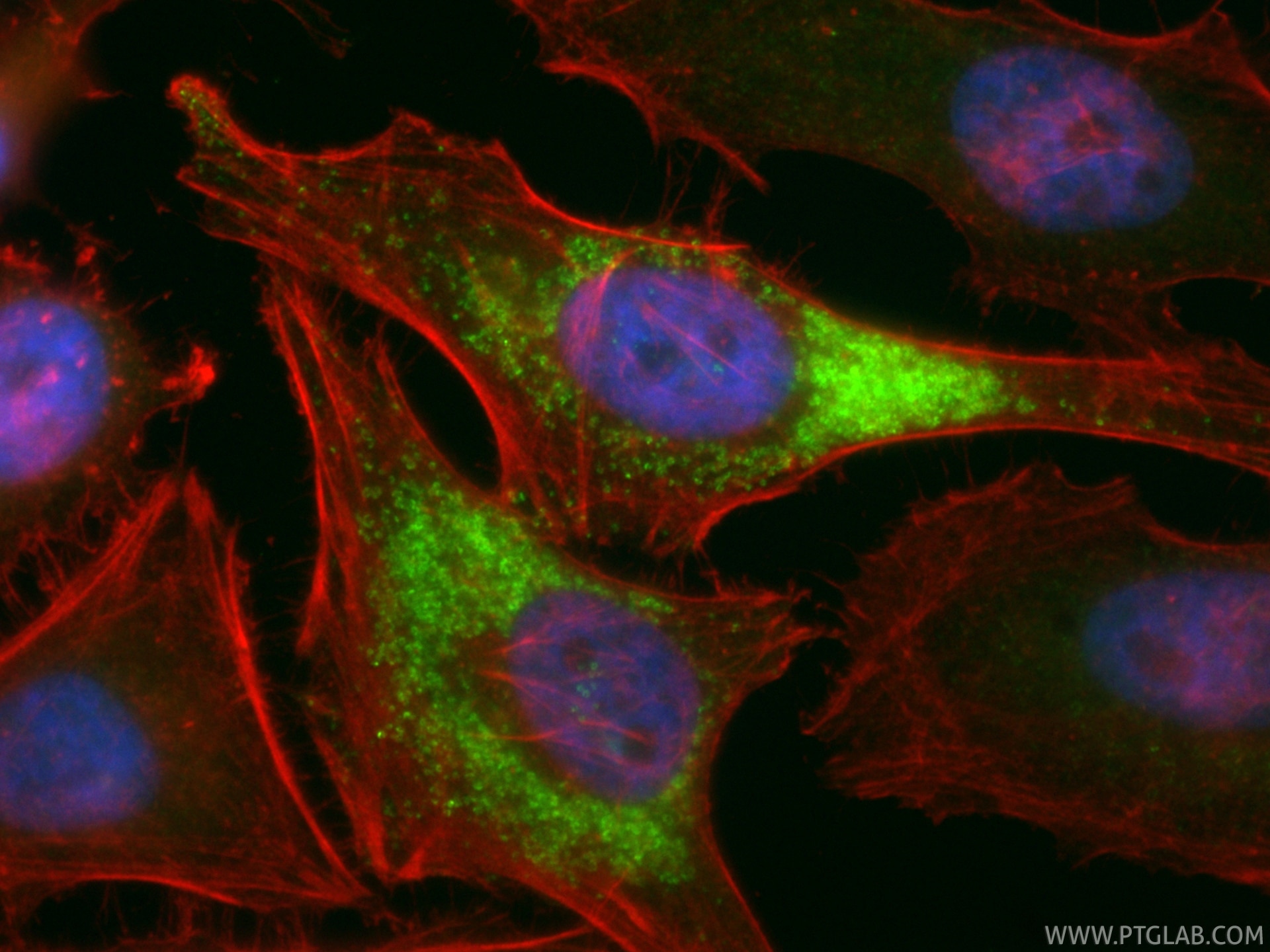 Immunofluorescent analysis of (4% PFA) fixed HeLa cells using CoraLite® Plus 488 LDLR antibody (CL488-82724, Clone: 1O11 ) at dilution of 1:200, CL594-phalloidin (red). Immunofluorescence (IF) / fluorescent staining of HeLa cells using CoraLite® Plus 488-conjugated LDLR Recombinant mon (CL488-82724)