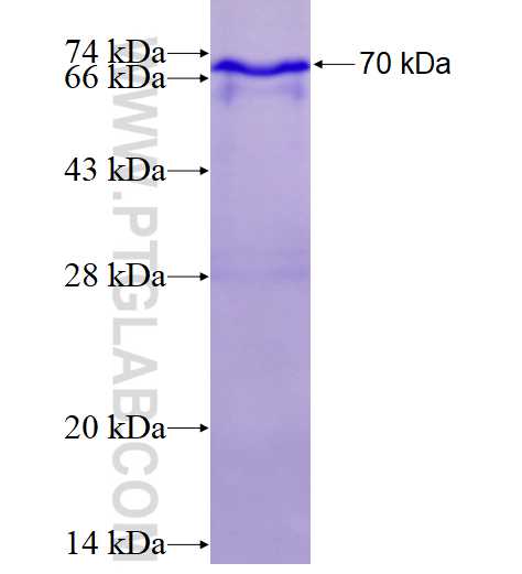 LDLR fusion protein Ag1236 SDS-PAGE