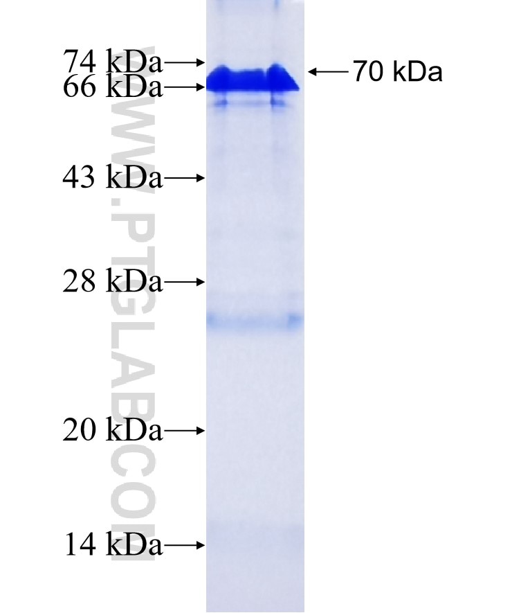 LDLR fusion protein Ag1236 SDS-PAGE